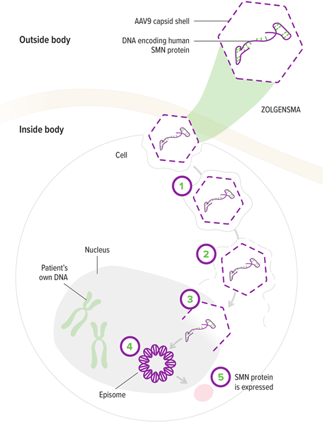 A diagram of ZOLGENSMA entering the nucleus of a motor neuron. 5 steps are labeled